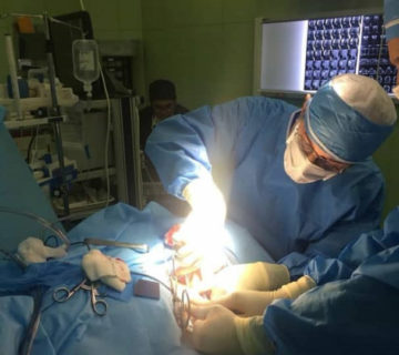 نورومانیتورینگ عمل جراحی Brachial Plexus Tumour