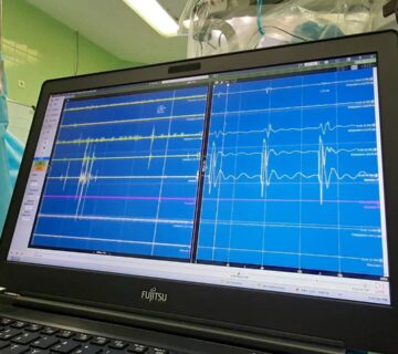 نورومانیتورینگ